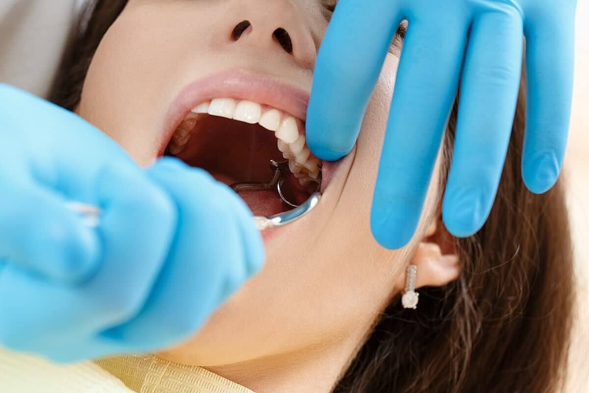 Dental Extraction